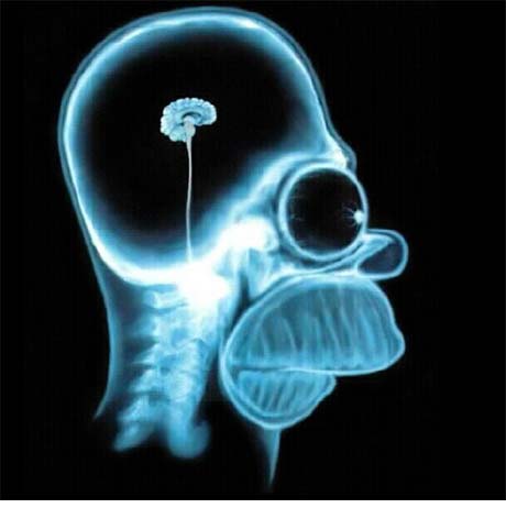 brain brain
